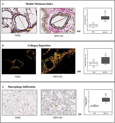 Metabolic Reprogramming in the Heart and Lung in a Murine Model of Pulmonary Arterial Hypertension